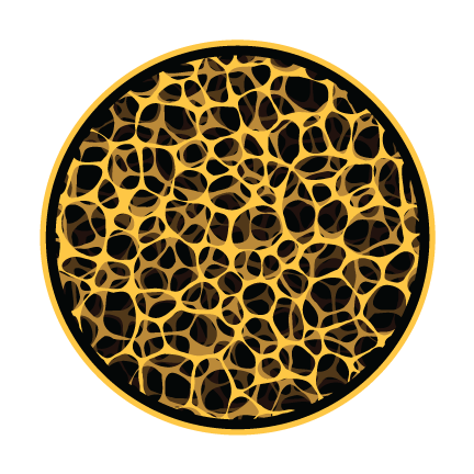 Cross-section of porous, osteoporotic bone with a thin lattice